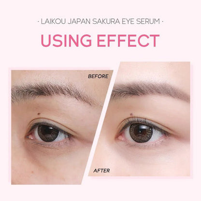 Sakura Augen-Serum Roller – Strahlende Augen ohne Müdigkeit | Vitamin C &amp; Hyaluronsäure {{ DaniFest }}